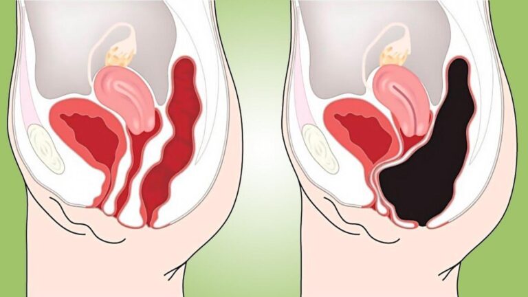 Une vieille astuce pour nettoyer naturellement votre colon et retrouver énergie et bien-être…