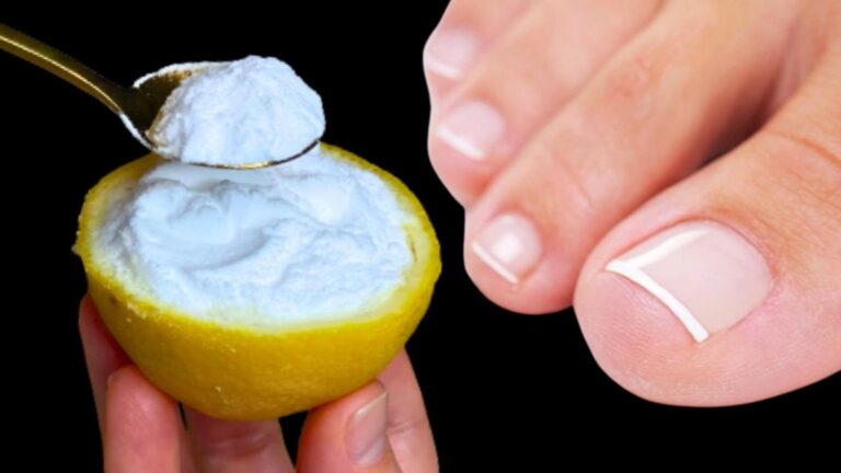 Cette astuce simple élimine les champignons des ongles en un clin d&rsquo;œil…