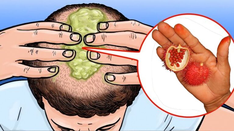 11 aliments pour des cheveux plus épais en 7 jours : découvrez notre guide essentiel !