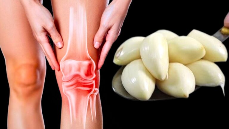 7 solutions naturelles pour soulager vos douleurs articulaires et varices rapidement