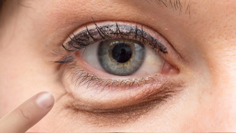 5 astuces naturelles pour dire adieu aux poches sous les yeux !