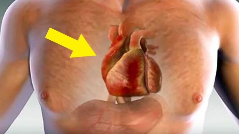 14 signes prémonitoires d&rsquo;un infarctus : écoutez votre corps pour agir vite !