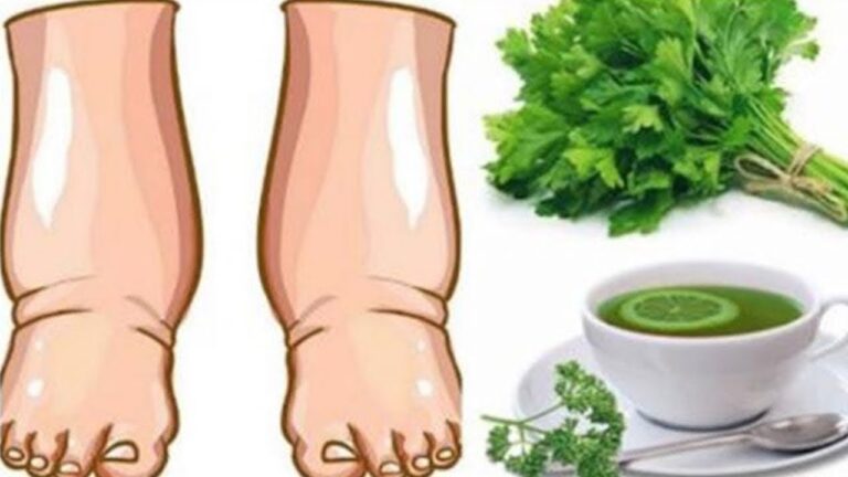 Détox : 7 jours pour des jambes légères avec ce thé maison !