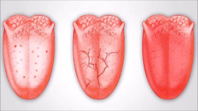 Découvre 5 signes sur ta langue qui révèlent des problèmes de santé !
