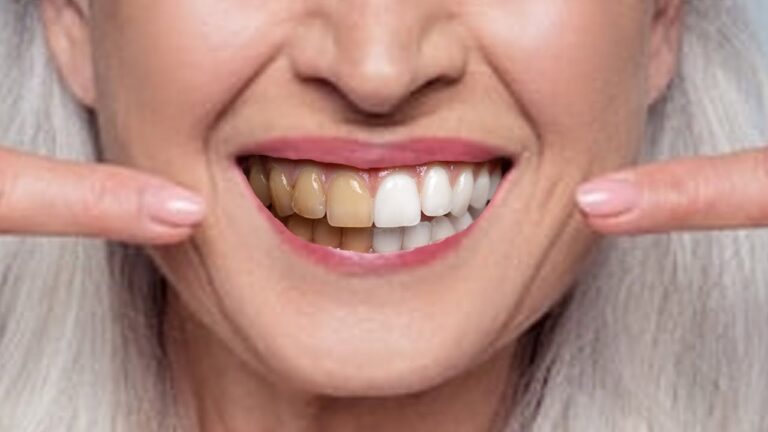 11 astuces naturelles pour avoir des dents blanches à tout âge !