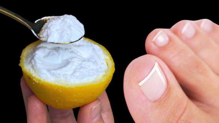 Éliminez 100 % des mycoses des ongles avec cet astuce naturelle !