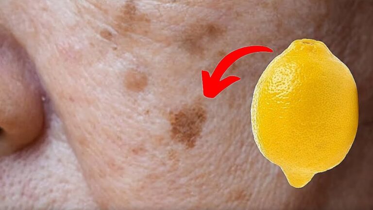 5 astuces efficaces pour éliminer les taches brunes avec des citrons