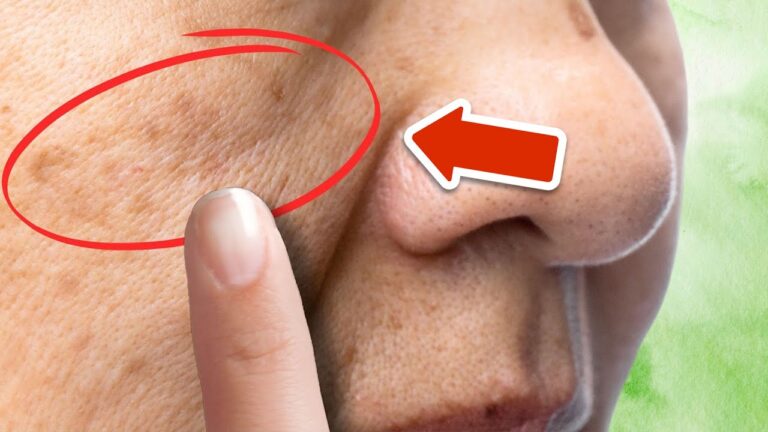 Éliminez 5 taches de vieillesse grâce à cette plante miracle et simplifiez votre routine !