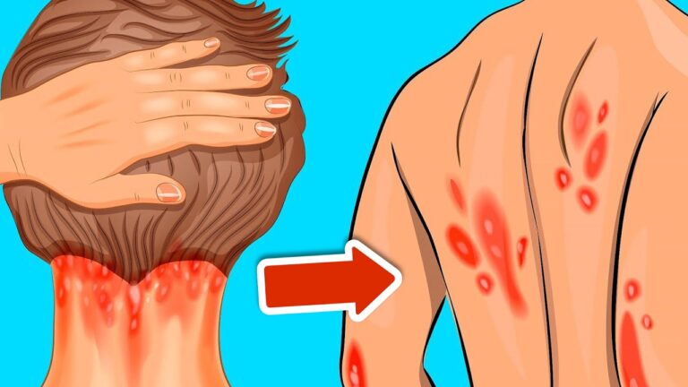 10 Signes révélateurs d&rsquo;un manque de vitamine D à ne pas ignorer !