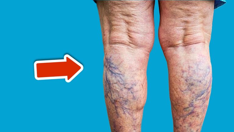 Découvrez le meilleur vitamine pour soulager 7 fois plus vos varices !