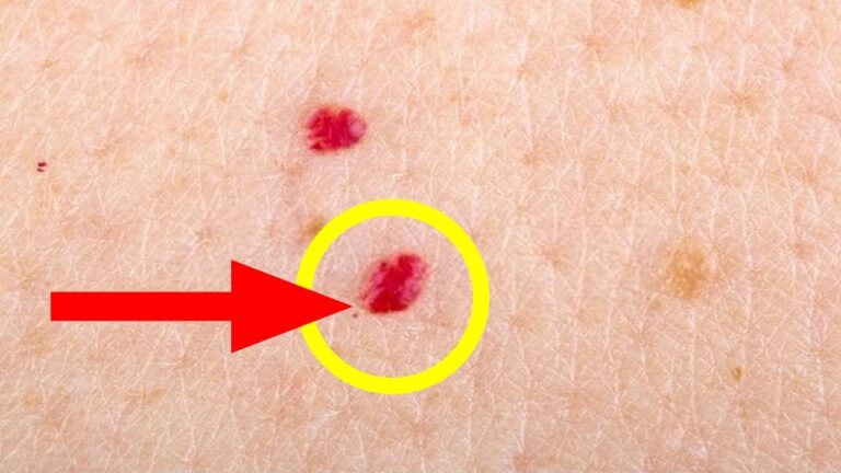 5 causes des points rouges sur la peau et quand les éliminer efficacement
