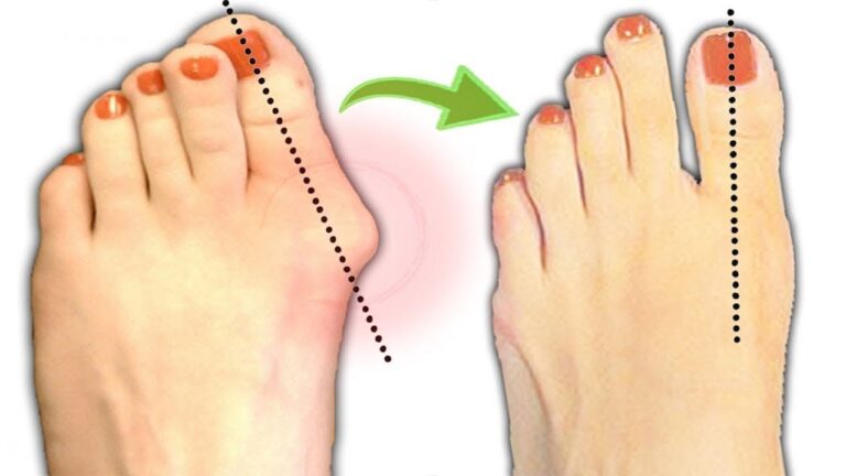 5 exercices efficaces pour soulager un surpoids confortablement chez soi