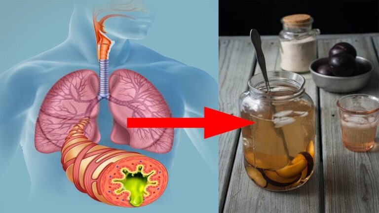 L&rsquo;élixir à 3 ingrédients qui élimine le mucus des poumons et renforce l&rsquo;immunité
