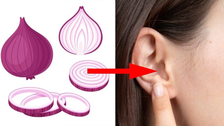 Placez un morceau d&rsquo;oignon dans votre oreille : vous serez étonné du résultat