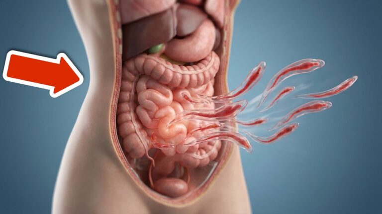 5 méthodes incroyables pour éliminer rapidement les vers intestinaux !